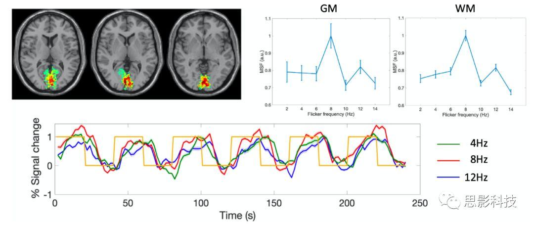 Magnetic Resonance Imaging:白质fMRI及静息态功能连接 - 知乎