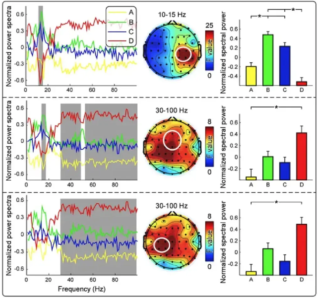 EEG信号时频域分析详解 - 知乎