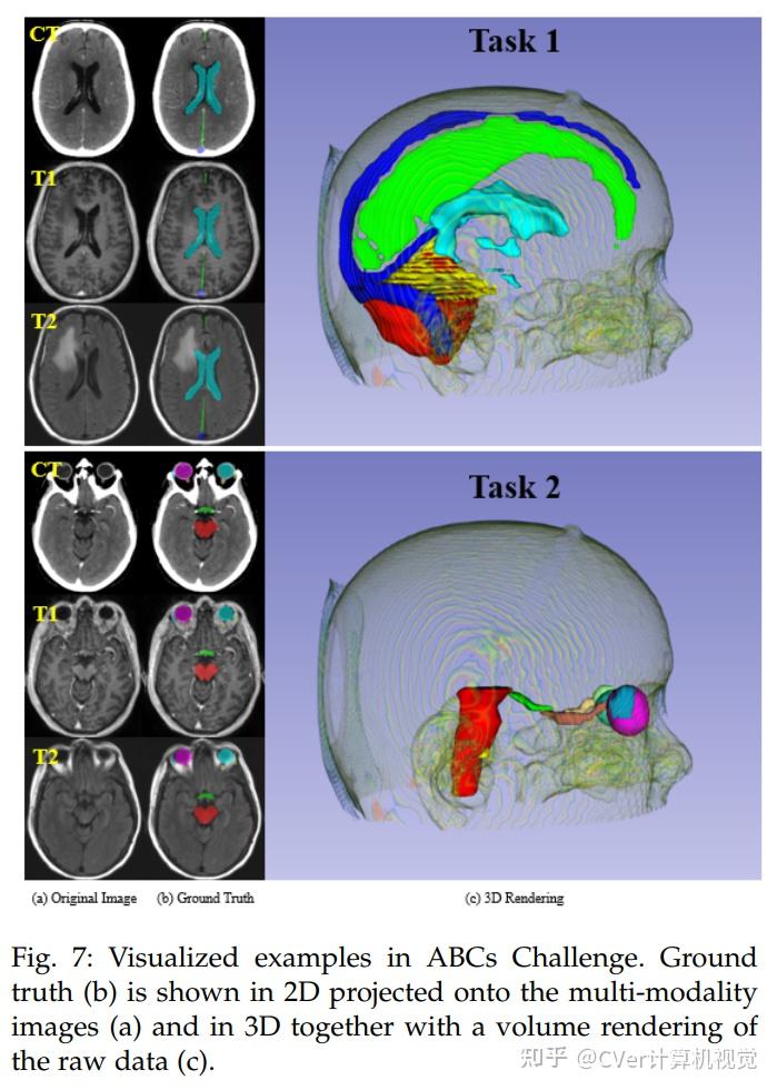 2020年最先进的3d医学图像分割方法