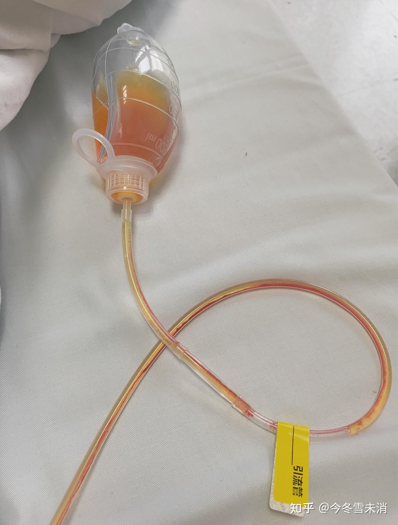 不管怎样,还是有种白赚了一个胆的感觉.