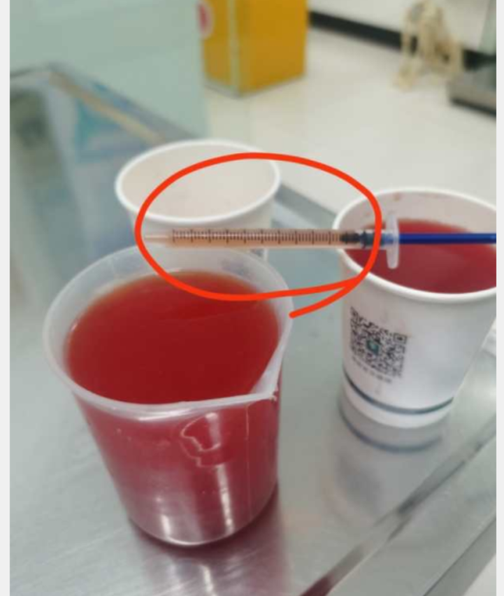 心源性腹水胸水