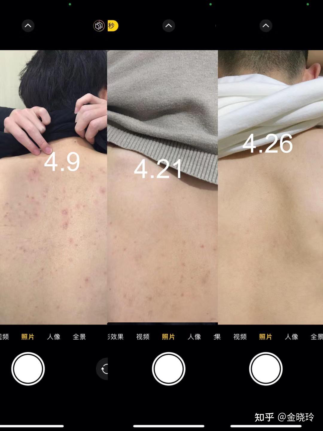 4:哈恩aha果酸沐浴露