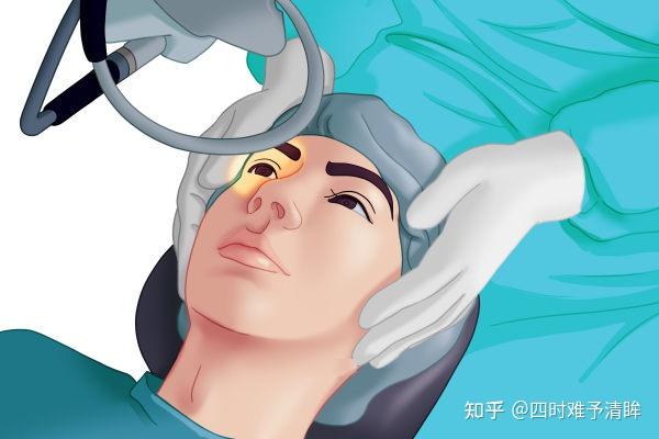 想做近视手术又担心风险这篇文章帮你解答疑惑