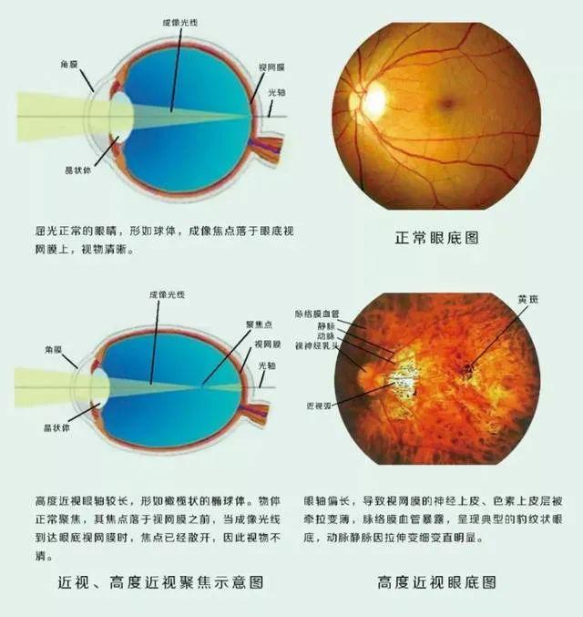 剧烈活动