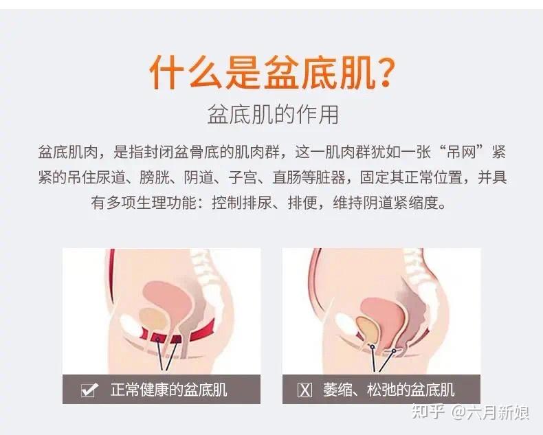 以及盆腔的脏器脱垂,子宫脱垂,yd前后壁膨出,这些最