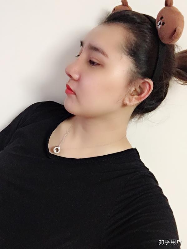 鼻子太挺拔有什么体验?