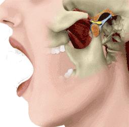 颞下颌关节脱位复位图图片