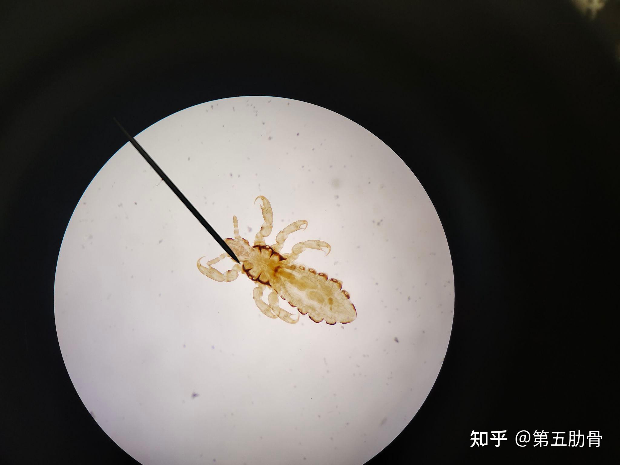 医学寄生虫学镜下实拍 知乎
