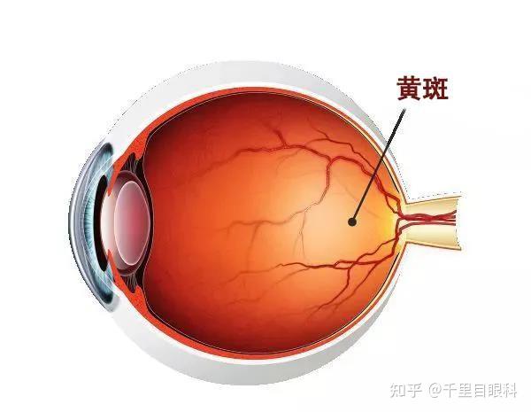 看冬奥享冰雪还要提防这种致盲眼病