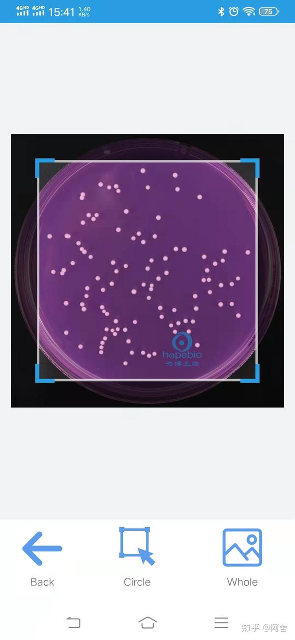 How To Count Microbial bacterial colonies in petri dish 知乎