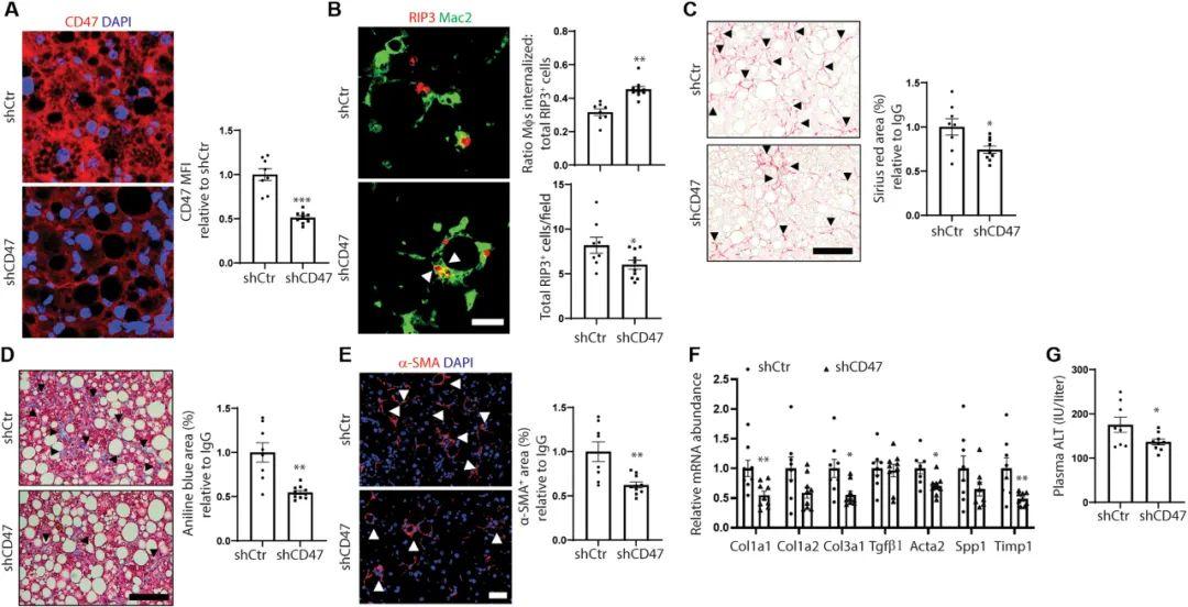 sci tra med | 肝巨噬细胞清除肝炎中坏死肝细胞,减少肝纤维化