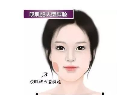 怎么才能瘦脸上的咬肌 v2-6fe3f0a60b70c0e1c2818835ffc7dc4b_r.jpg