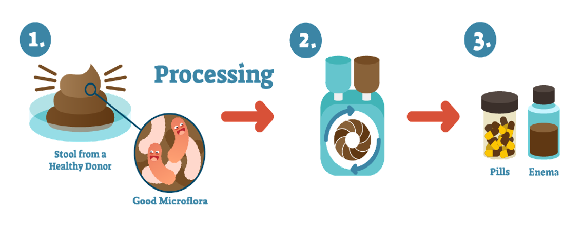 菌群移植技术及流程 - 知乎