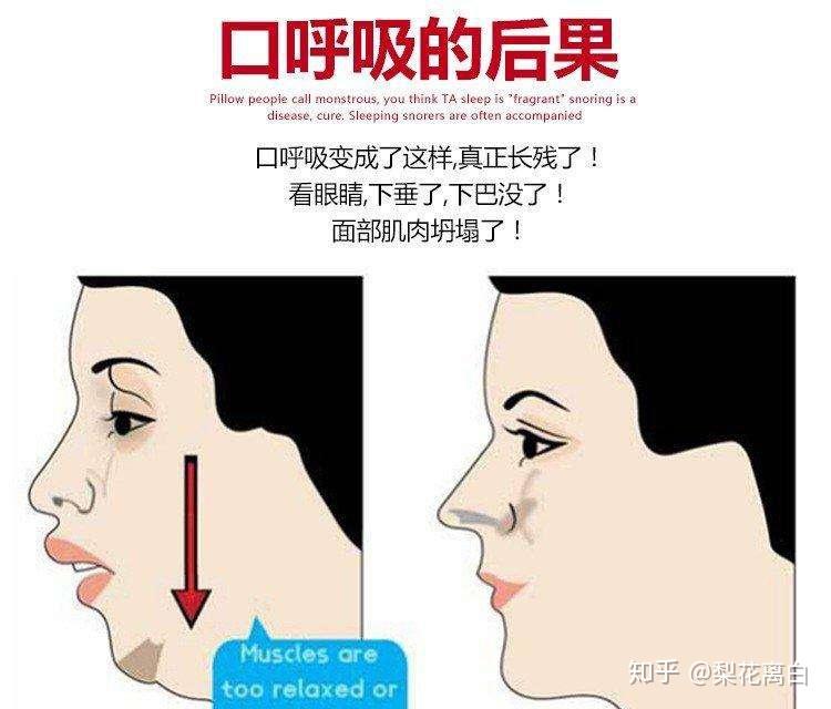 v2-7003a85b217af1aab1ef4f3af1b6a690_r.jpg