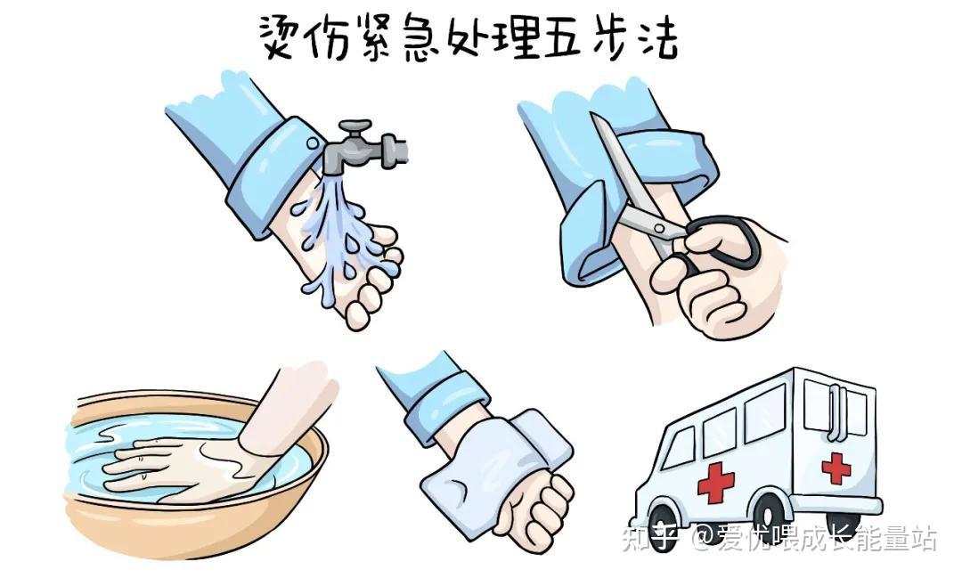 宝宝烫伤紧急护理的注意事项