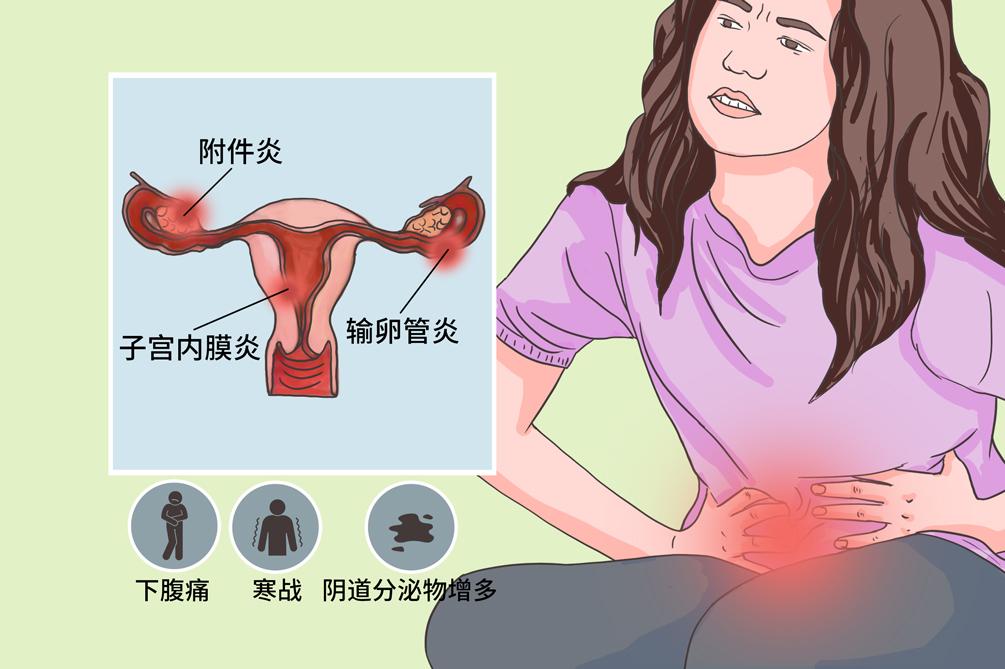 女性附件炎疼痛图片