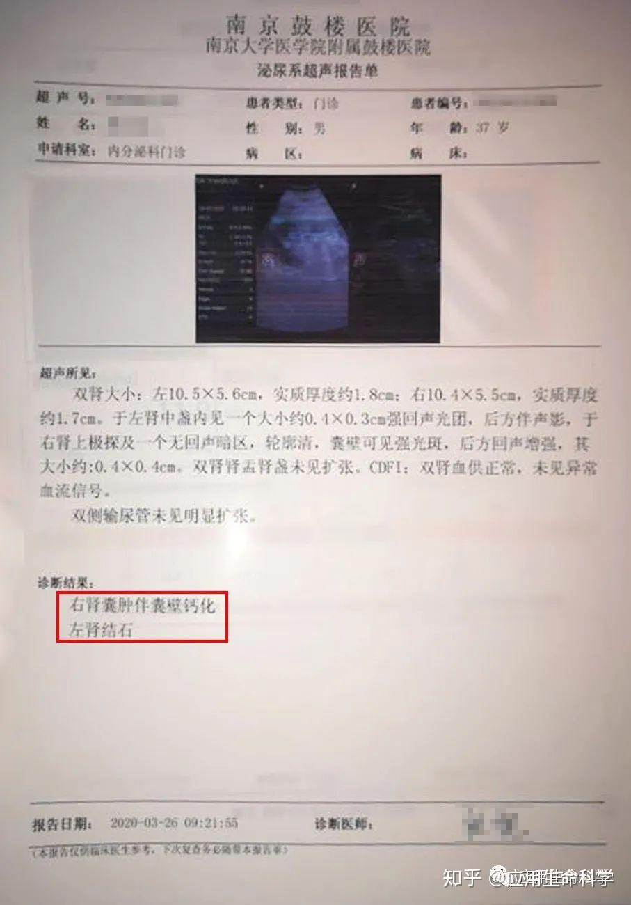 痛风肾超声图片图片