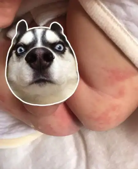 宝宝屁屁红,是不是应该换个纸尿裤?