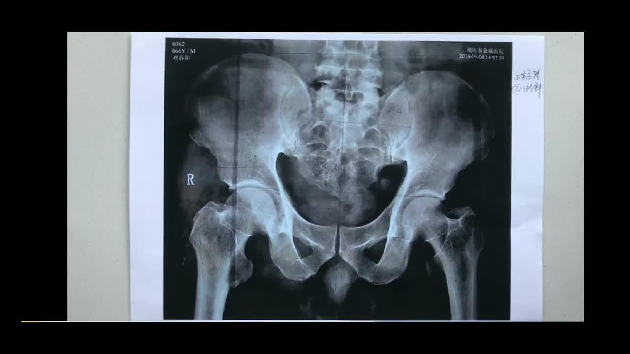 3 小时前 · 1065 次播放活动涨知「视」了· 社科人文季骶髂关节体态