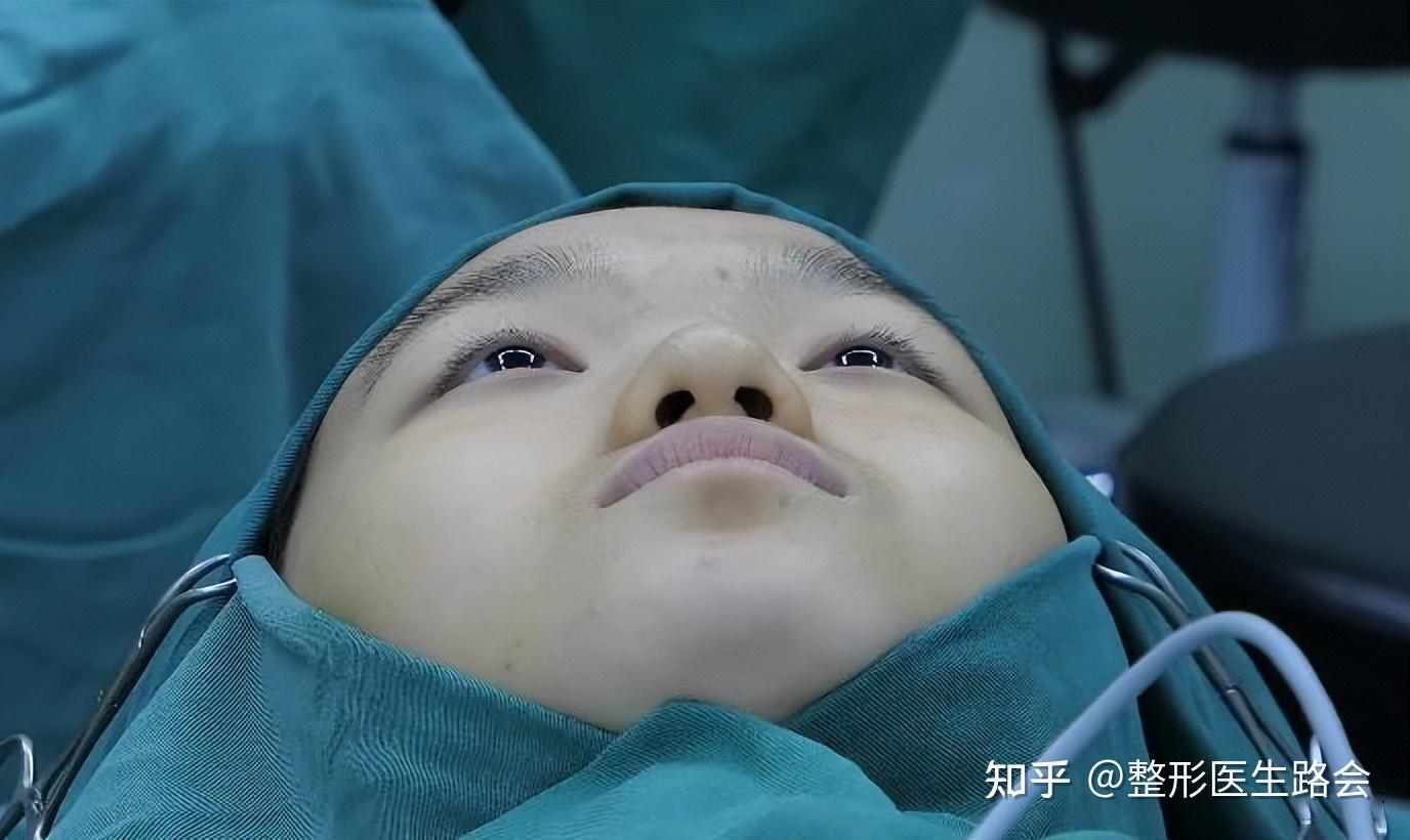 5小时20分"全脸整形",20岁小姑娘手术过程「真实细节」分享 - 知乎