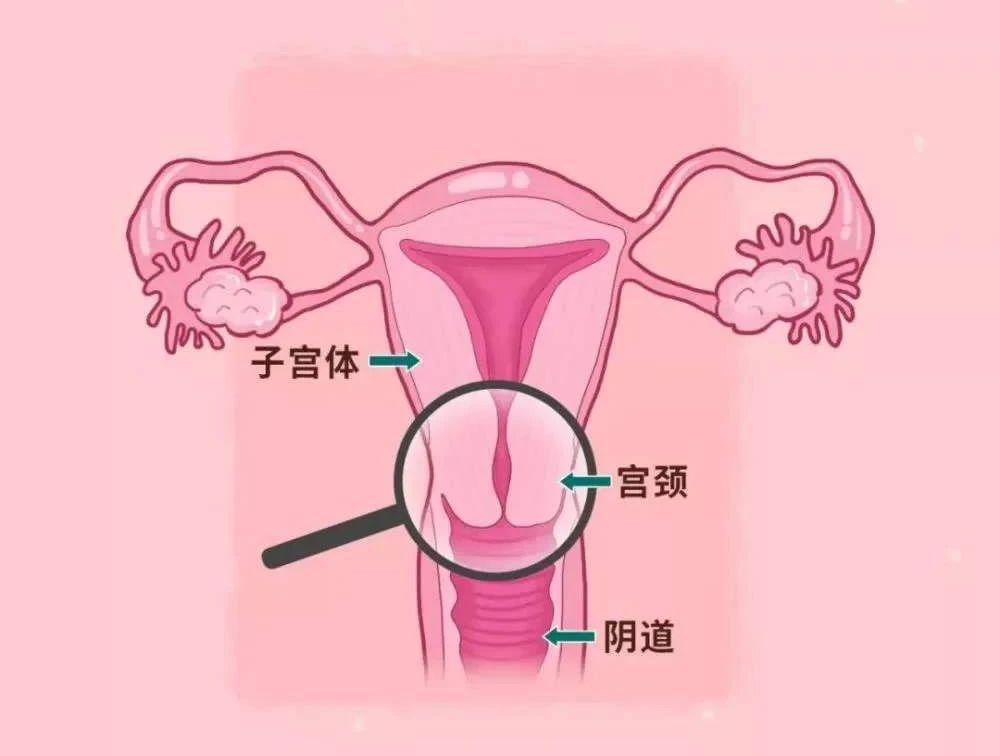 子宫内部的样子图片
