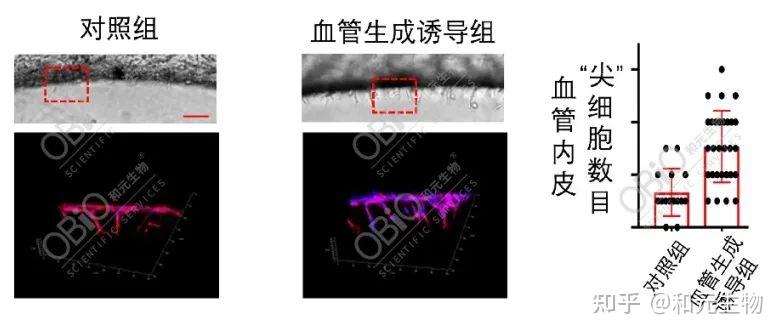新品发布 | 原代肺微血管生成实验——肺脏研究新手段 - 知乎