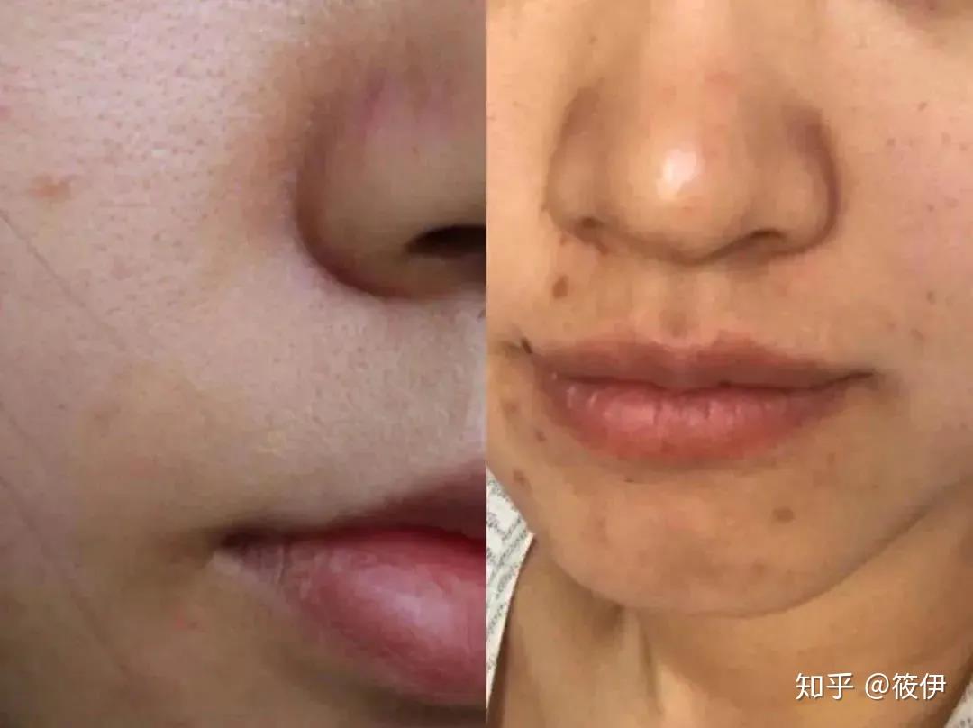 烟酰胺为什么你用了却不白