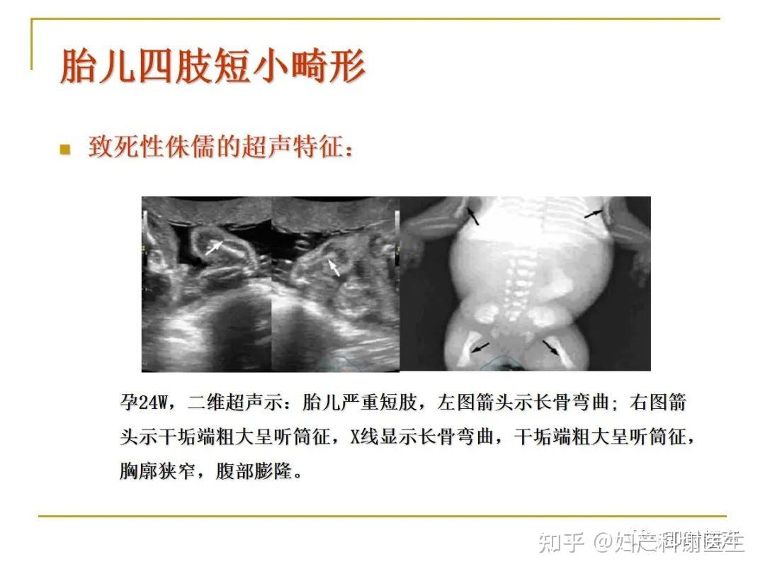 B超检查能100％检查出胎儿畸形吗？--中国数字科技馆