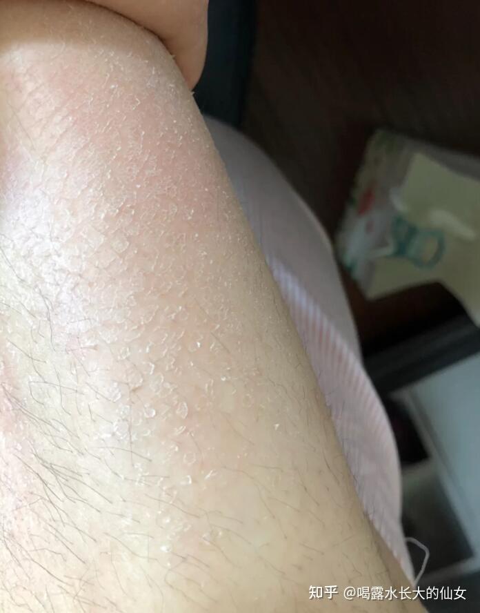 脚干起皮可以摸身体乳吗(脚干起皮可以摸身体乳吗女生) 脚干起皮可以摸身体乳吗(脚干起皮可以摸身体乳吗女生)