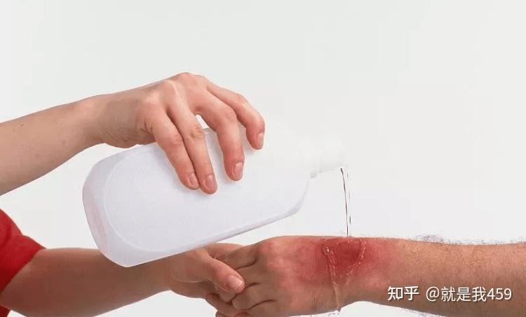 红蓝光科普系列丨摔伤、烫伤、伤口感染……家庭常见外伤还可以这样处理! - 知乎