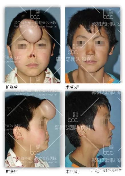 女人的鼻子好看到底犯了什么错