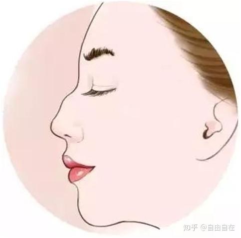 驼峰鼻是什么鬼? - 知乎