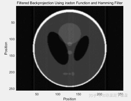 iradon,iradon函数参数 iradon,iradon函数参数