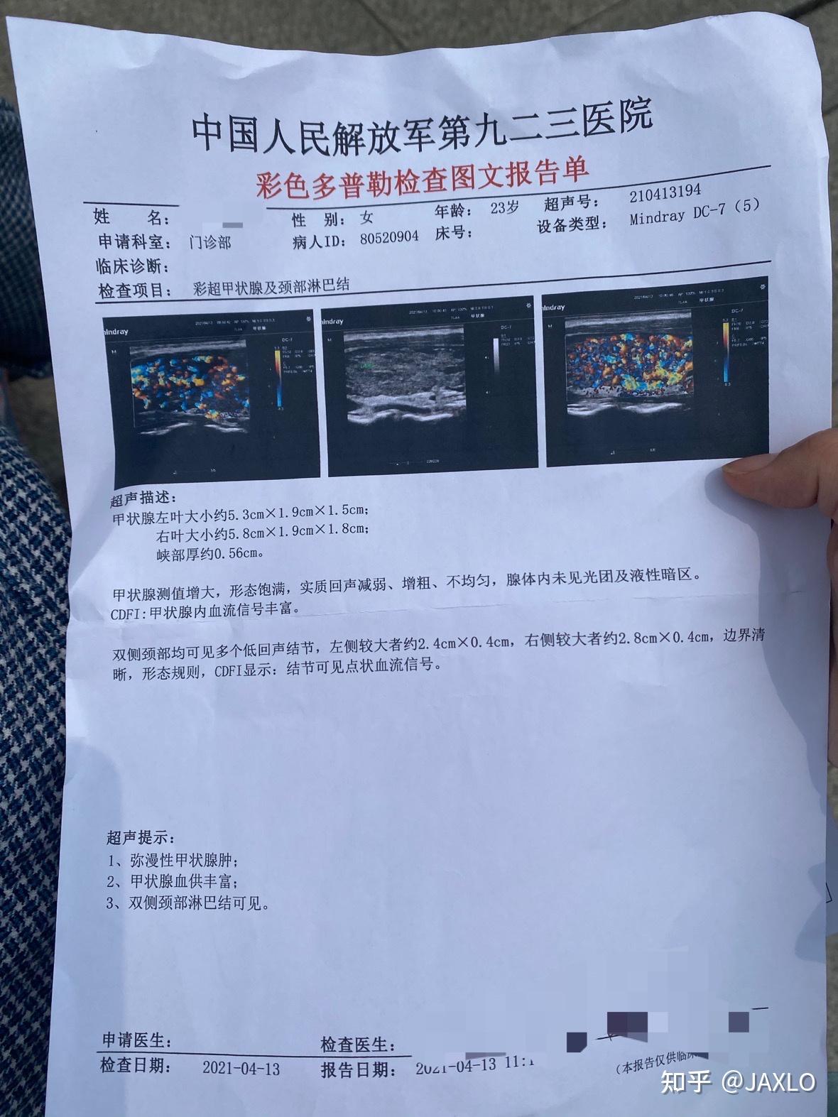 记录我的治疗甲亢过程