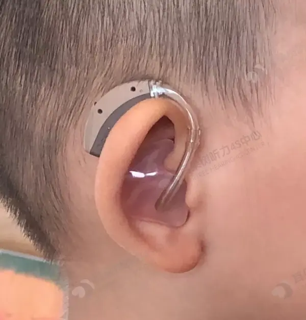 首次验配助听器如何使用和保养儿童篇