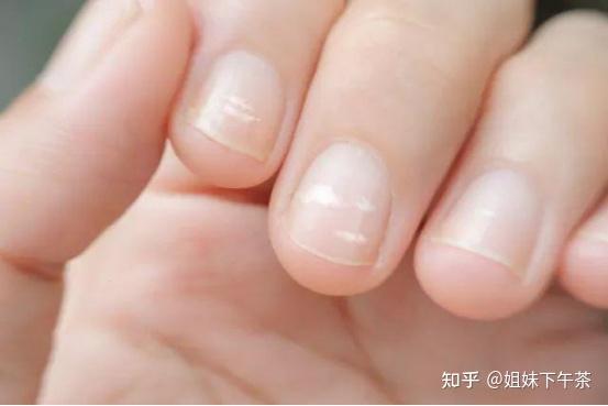 奔三请自查 女人亚健康的几种表现 知乎