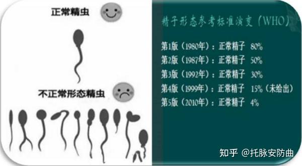 精索静脉曲张什么程度下需要做手术呢? - 知乎