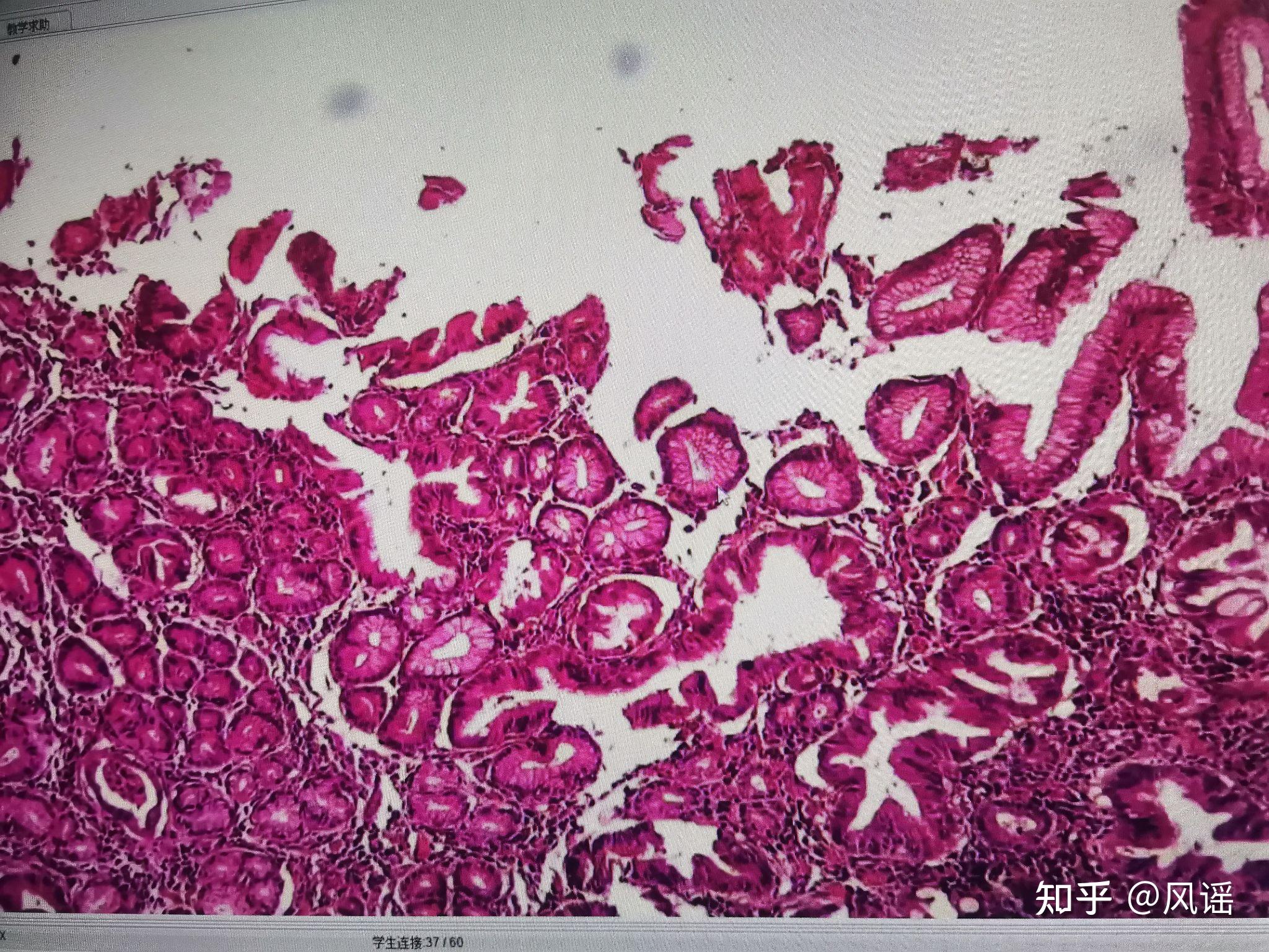 病理学实验切片和病变特点