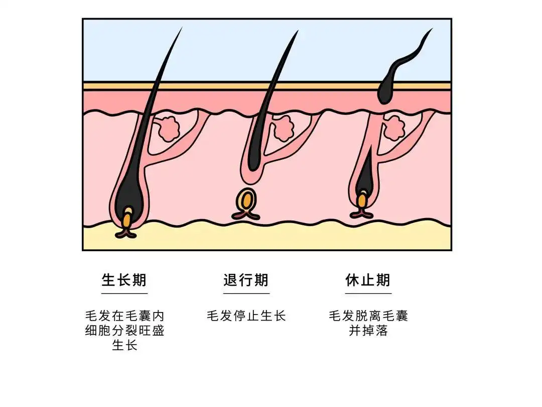 Hair growth cycle illustration. Anatomical diagram of development hair follicles from anagen ...