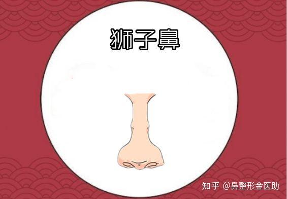 了解一下常见的鼻型都有哪些? - 知乎