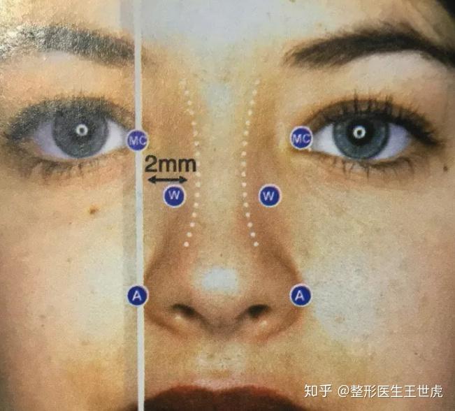 根据鼻部审美标准来判断,从正面看,理想的鼻背美学线应从眉脊开始