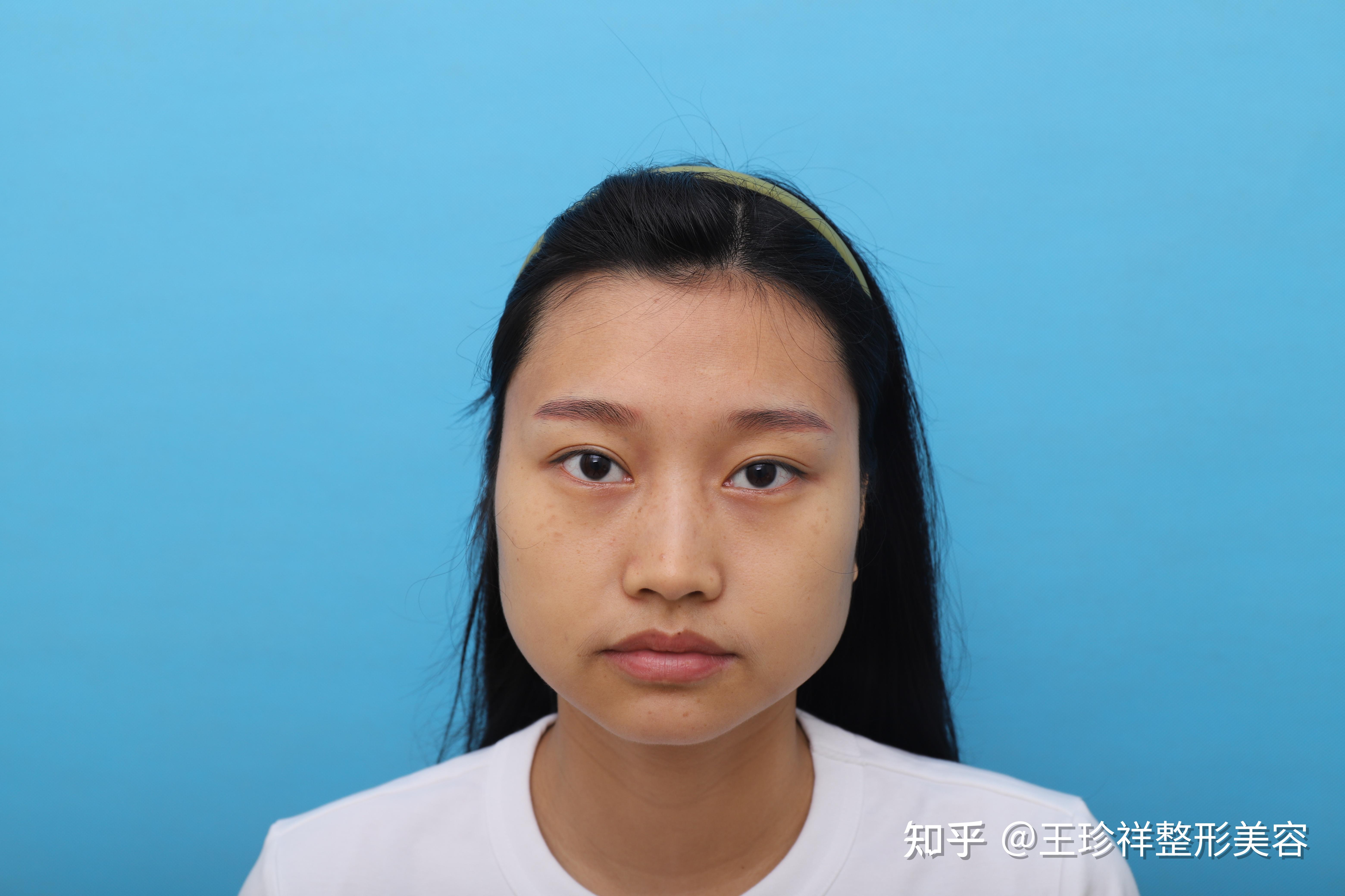 重庆磨骨削骨颌面手术记录推荐