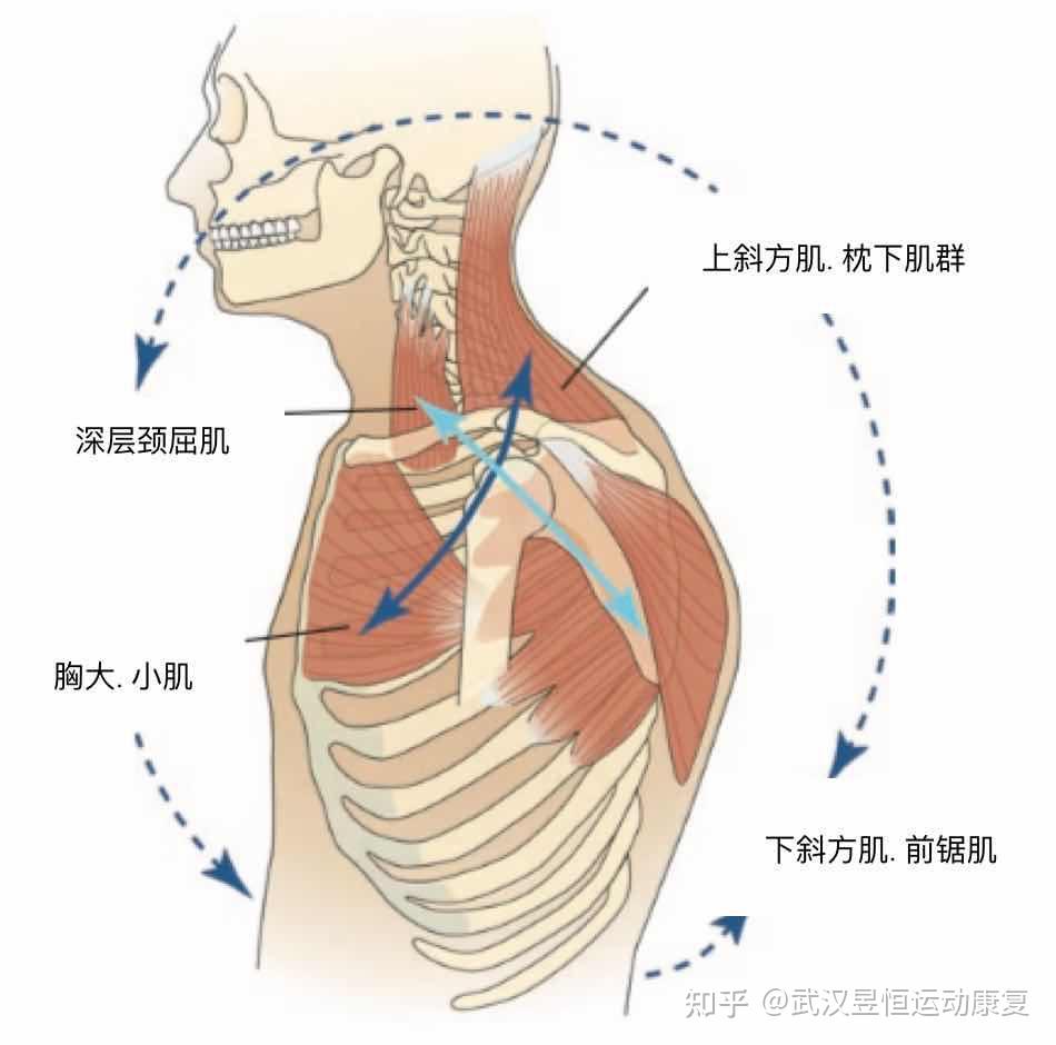 如图所示,上交叉的人一个人胸小肌,胸大肌,斜角肌,斜方肌,肩胛提肌高