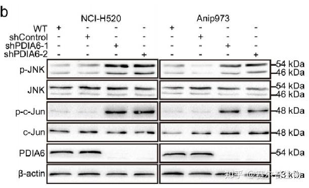 细胞自噬看这篇发生机制检测方法研究思路看完全明白