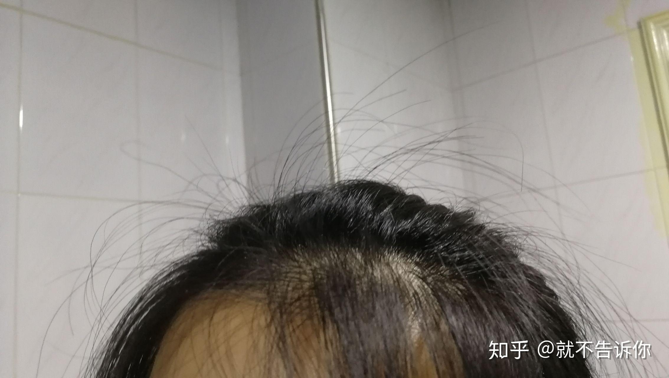 头发容易炸毛是一种怎样的体验? - 知乎