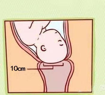 顺产宫口开十指别真以为是十根手指宽