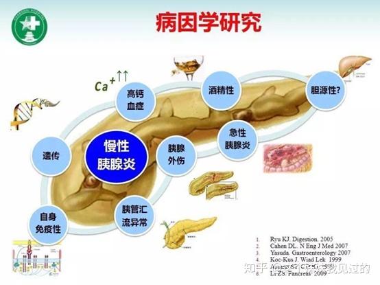 v2-74cad8e3f41b52bc2ab6a33451c75f37_r.jpg