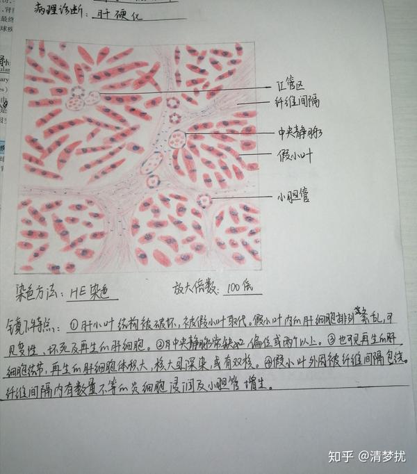 肾细胞手绘图图片