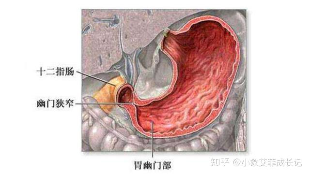 还有一种疾病应赶紧就医