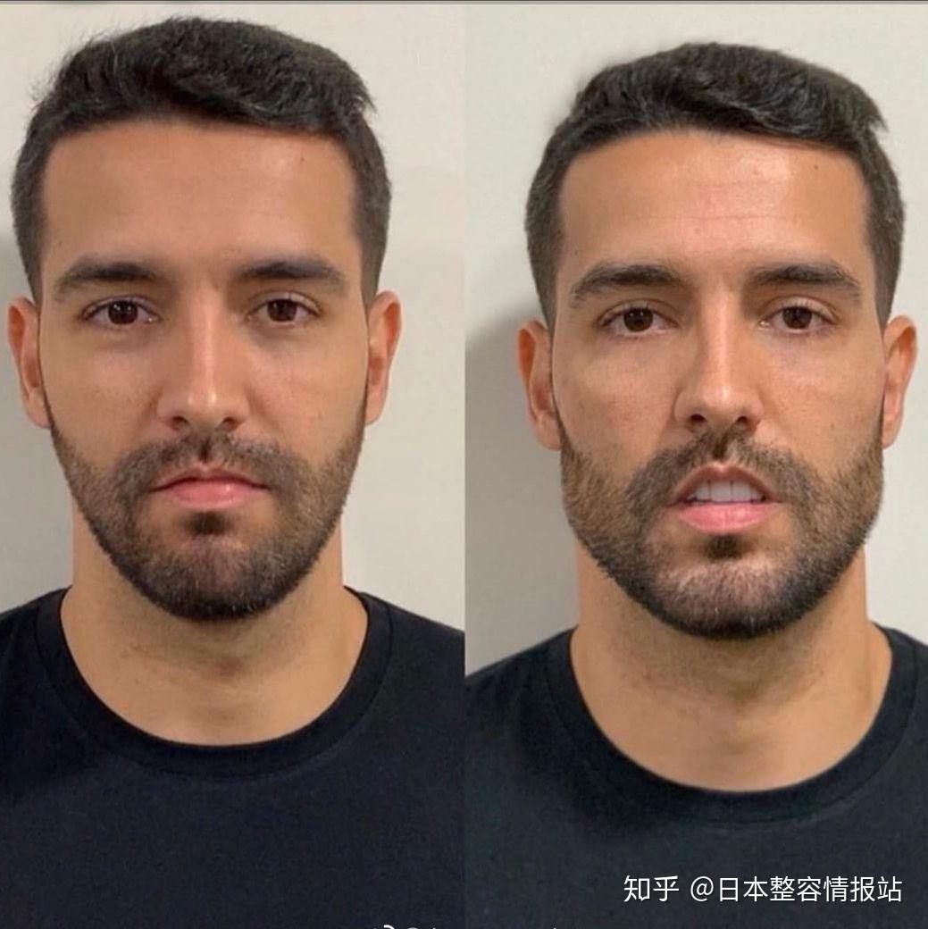 男生的脸都是有点棱角好看!冲浪康到一组对比图知乎用户fm68v4